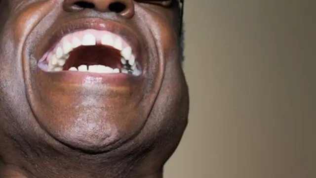 A man laughing