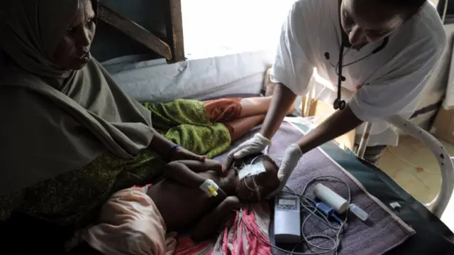 Child getting treatment in Somalia 2011