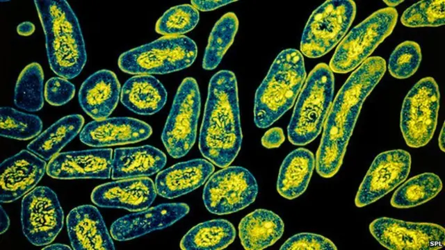 Tuberculosis bacteria