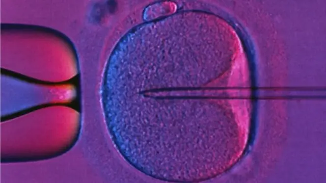 IVF: Patients face postcode lottery for treatment