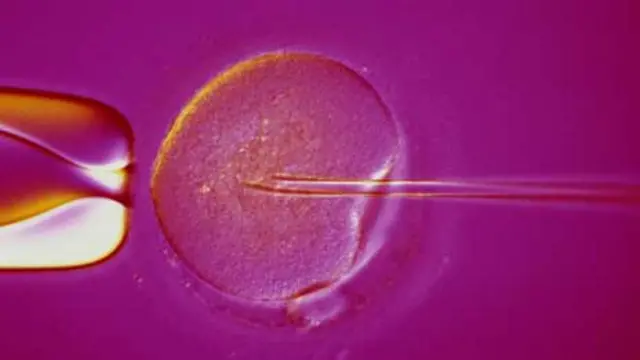 IVF