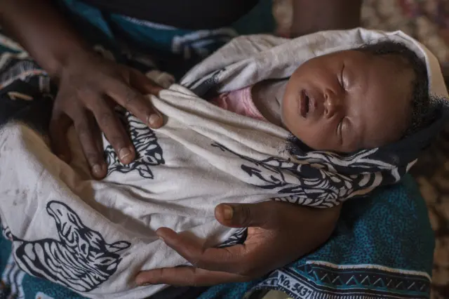 Baby in Malawi