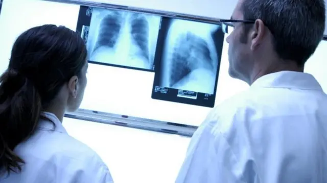 Doctors look at an x-ray