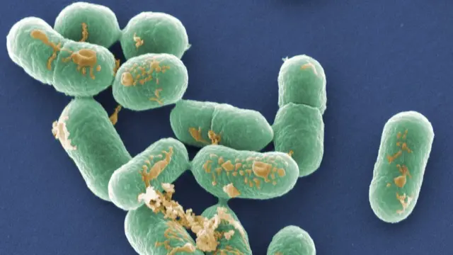 Listeria bacteria