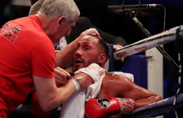 James DeGale talks to his trainer in between rounds