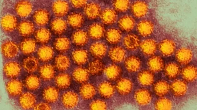 Norovirus