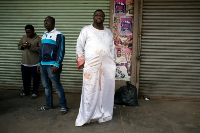 Samson Sangojinmi, a Nigerian pastor injured by a vigilante mob, stands outside his church in Pretoria, South Africa February 18, 2017.