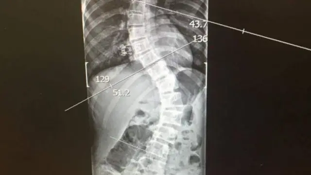 X-ray