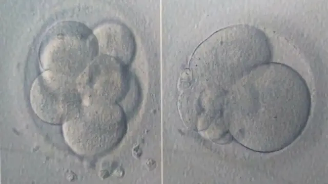 Stacey Oswin's failed embryos