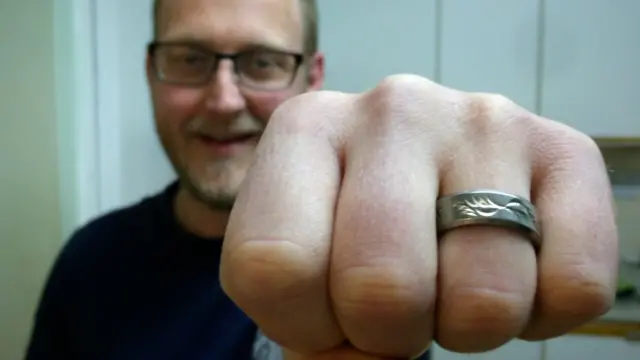 
          Andy Freeman stretching out his left arm, with hand clasped and wearing wedding ring
        