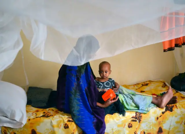 
          A malnourished child is fed a special formula by her mother at a regional hospital in Baidoa town, the capital of Bay region of south-western Somalia on March 15, 2017
        