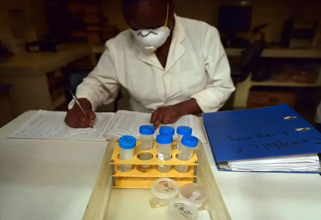 
          A laboratory technician logs samples in viles from tuberculosis (TB) patients to be tested for TB strains at a Medecins Sans Frontieres (MSF)-run clinic in Nairob
        