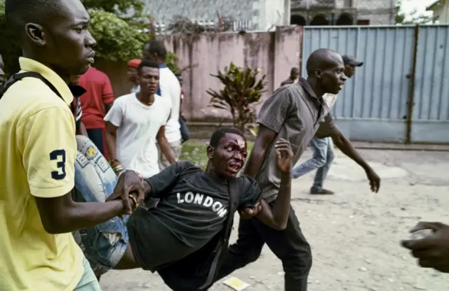 
          Injured man carried by opposition protesters away from the gathering
        