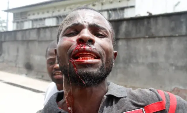 Man shows bloodied face to camera