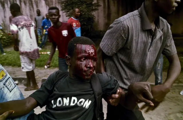 
          Man with bloodied face wearing a t-shirt with London written on it is carried from the scene
        