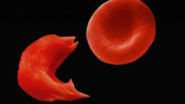 Blood cells