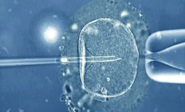 IVF treatment