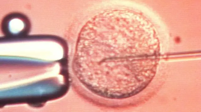 IVF treatment