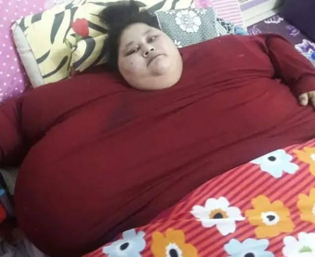 Eman Ahmed at 500kg weight before surgery