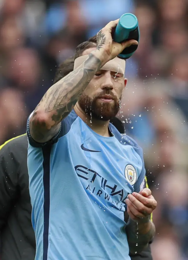 Otamendi sprays water on his injured head