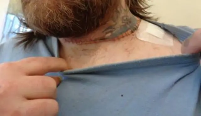 Slashed neck