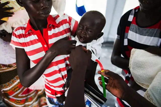 A UNICEF officer measures a South Sudanese child's arm in a mobile clinic in Rejaf on October 24, 2015.