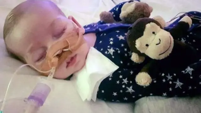 Charlie Gard