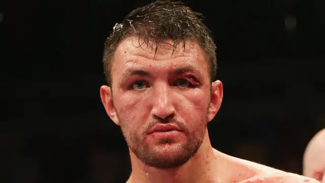 Hughie Fury