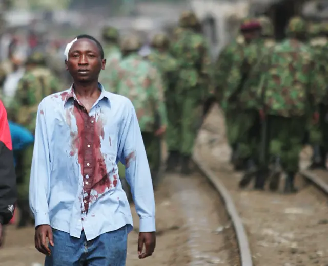 A member of the Kikuyu tribe living in the Kibera slum of Nairobi walks with his bloodied shirt away from Kenyan police during ethnic clashes in Nairobi 29 January 2008. The slaying of a Kenyan opposition lawmaker sparked riots 29 January 2008 across the east African nation already reeling from weeks of deadly clashes set off by disputed elections.