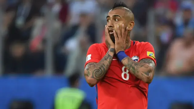 Arturo Vidal reacts