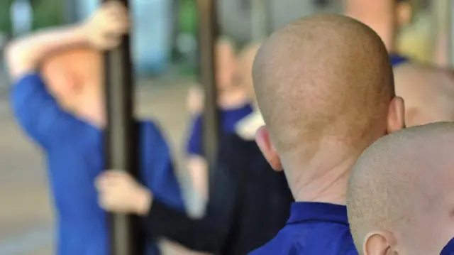 Children with albinism