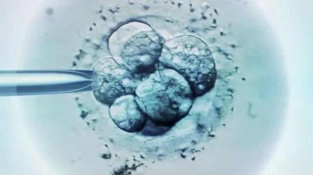 IVF treatment