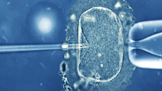 IVF