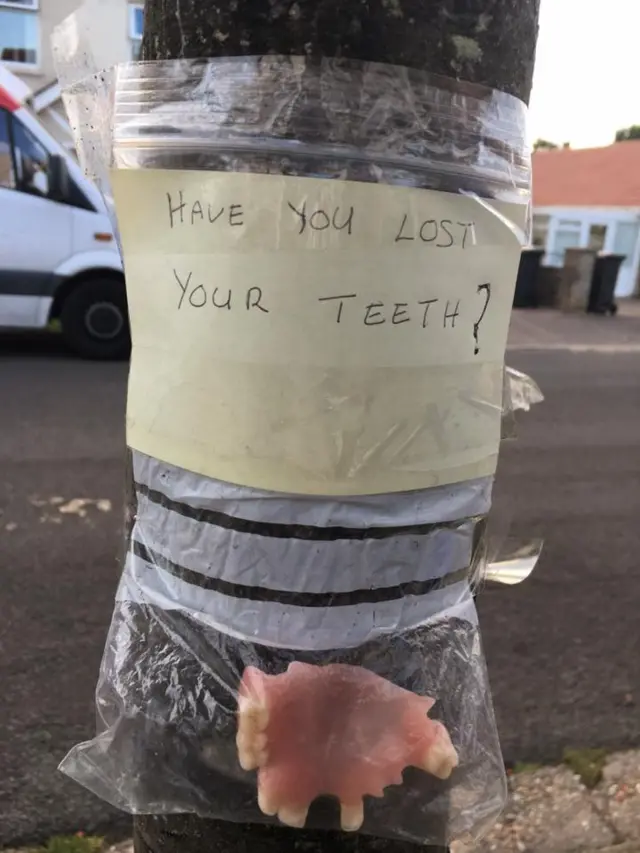 false teeth