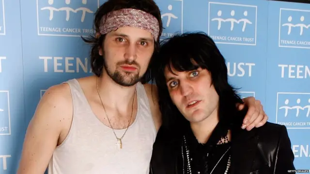 Serge and Noel Fielding