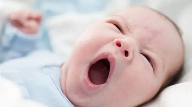 Baby yawning