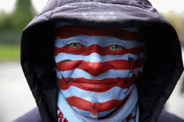 Burnley supporter