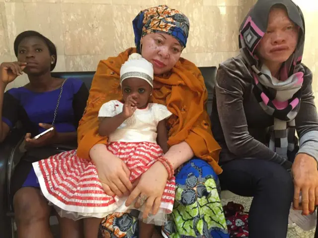 Two women with albinism, one of who is pictured with a little girl who does not have the condition