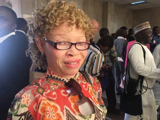 A woman with albinism