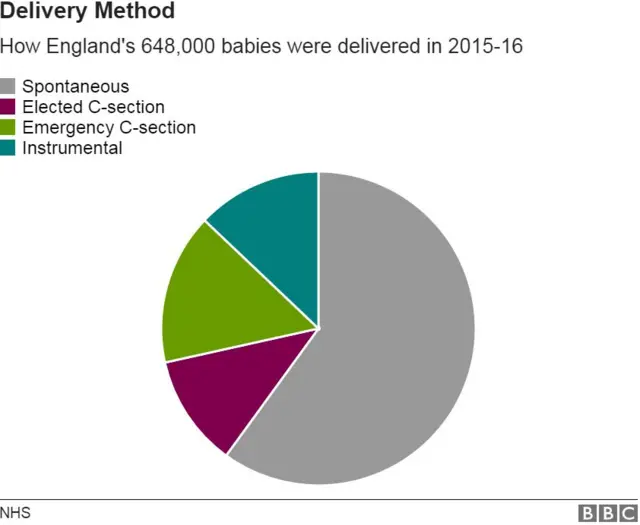 Pie chart showing different birth types