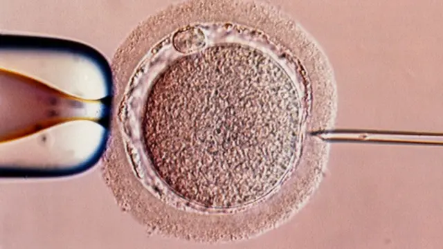 IVF