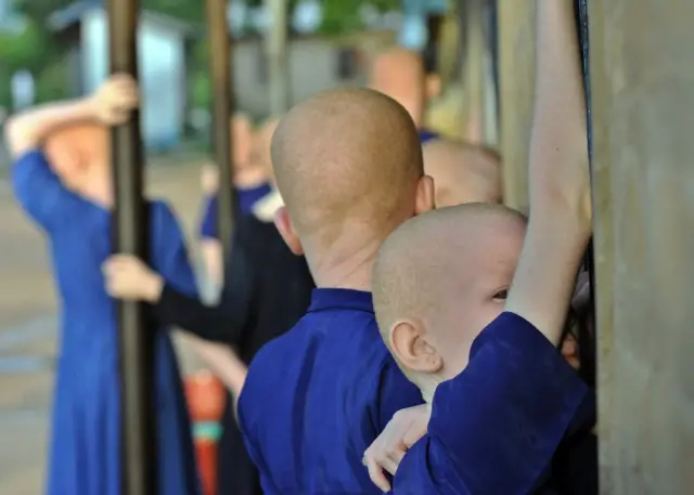 Albino children take a break on January 25, 2009 in a recreational hall at the Mitindo Primary School for the blind, which has become a rare sanctuary for albino children