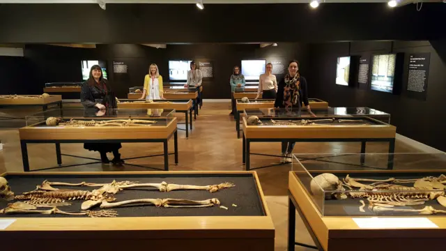 Skeleton exhibition