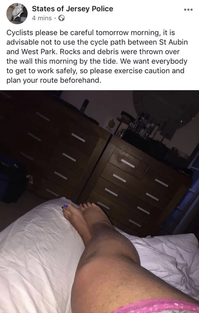 Tweet with leg photo sent in error