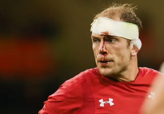 Alun Wyn Jones bleeding