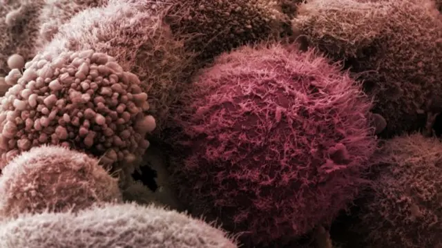 Pancreatic cancer cells