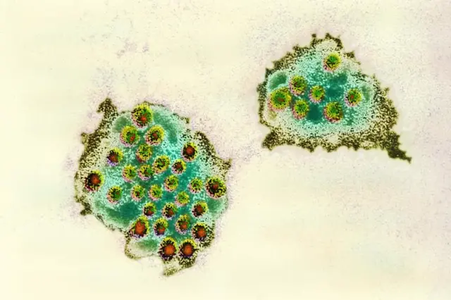 A photograph showing the Norovirus