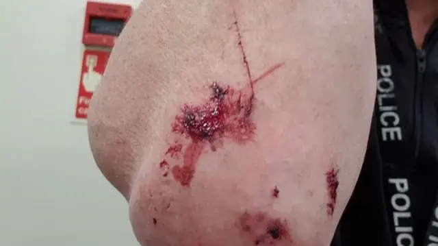 Injured arm