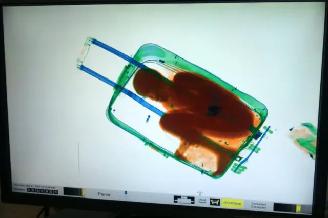 A file photo taken on May 08, 2015 shows an X-ray image showing 8-year-old Ivorian boy Adou Ouattara hidden in a suitcase