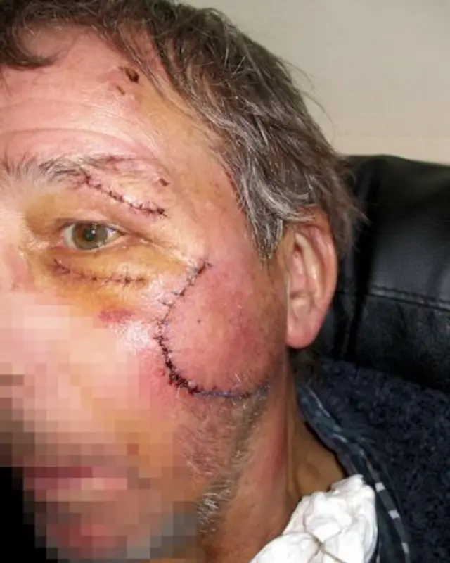 Hastings attack victim's injuries